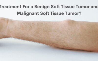 Treatment For a Benign Soft Tissue Tumor and Malignant Soft Tissue Tumor?