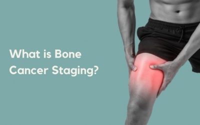 What is Bone Cancer Staging?