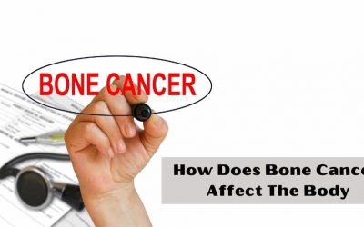 How Does Bone Cancer Affect The Body?